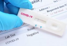 Os principais CEOs sinalizam que as vacinas da Covid podem estar no caminho